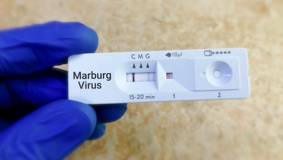 Korkutan Virüs Tehlikesi Yaklaşıyor! Yeni Virüs Hızla Yayılıyor…