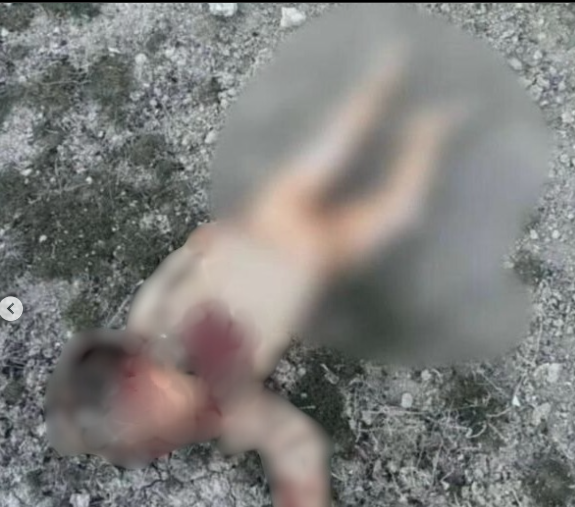 Konya’daki Şüpheli Çocuk Ölümü: Köpek Saldırısı mı, Cinsel İstismar mı?