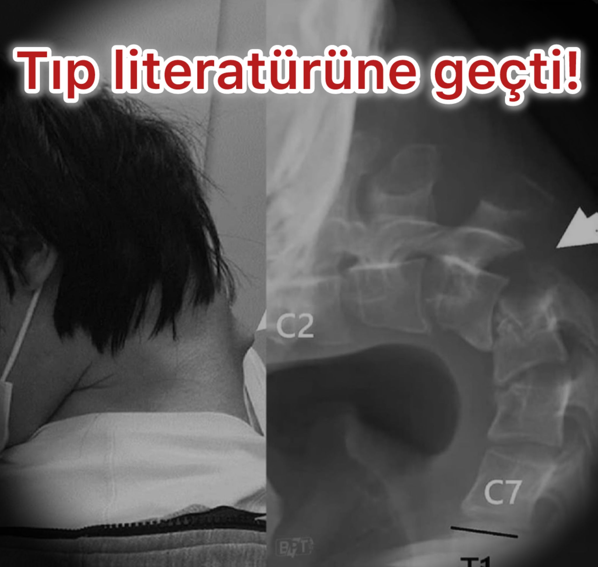 Sürekli Telefona Bakarsak Ne Olur?