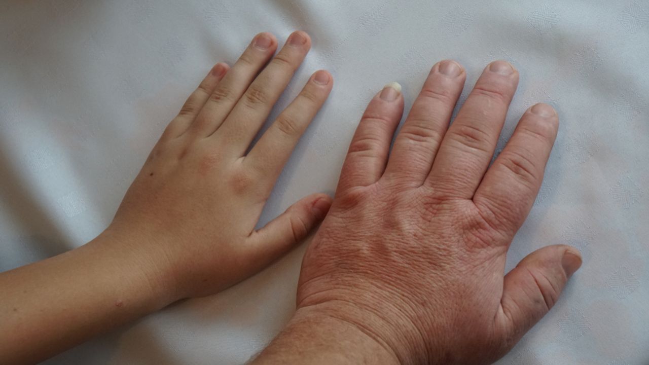 İnsan uzuvları yeniden büyüyebilir mi? Cevap Axolotl’da gizli