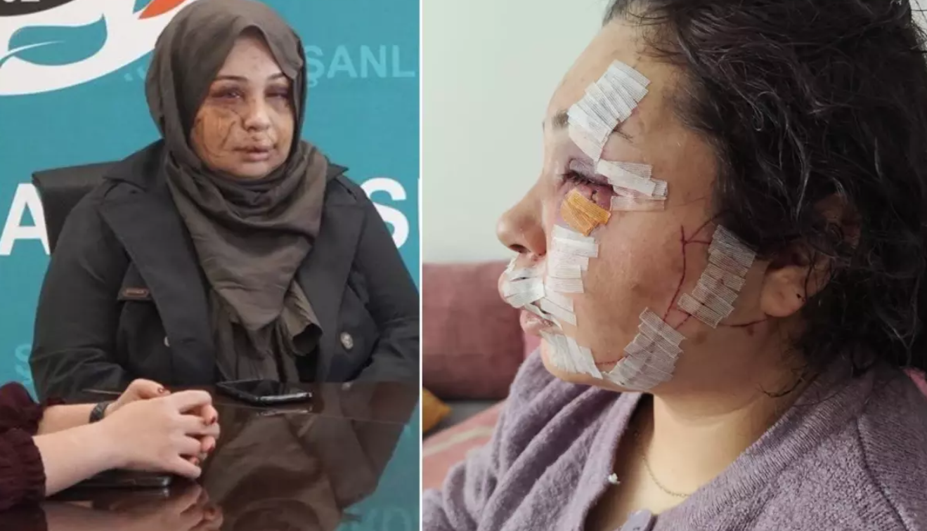 Koruma Polisi Şiddetinde “Serbest Bırakılma” Kararı Bozuldu: Yasin Çakmak Tutuklandı!