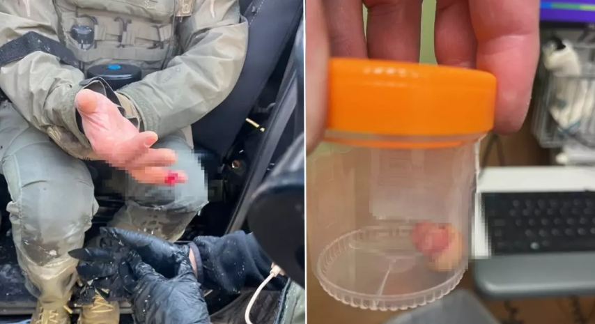 Minneapolis’te Protesto Vahşeti: Görevlinin Parmağı Isırılarak Koparıldı!