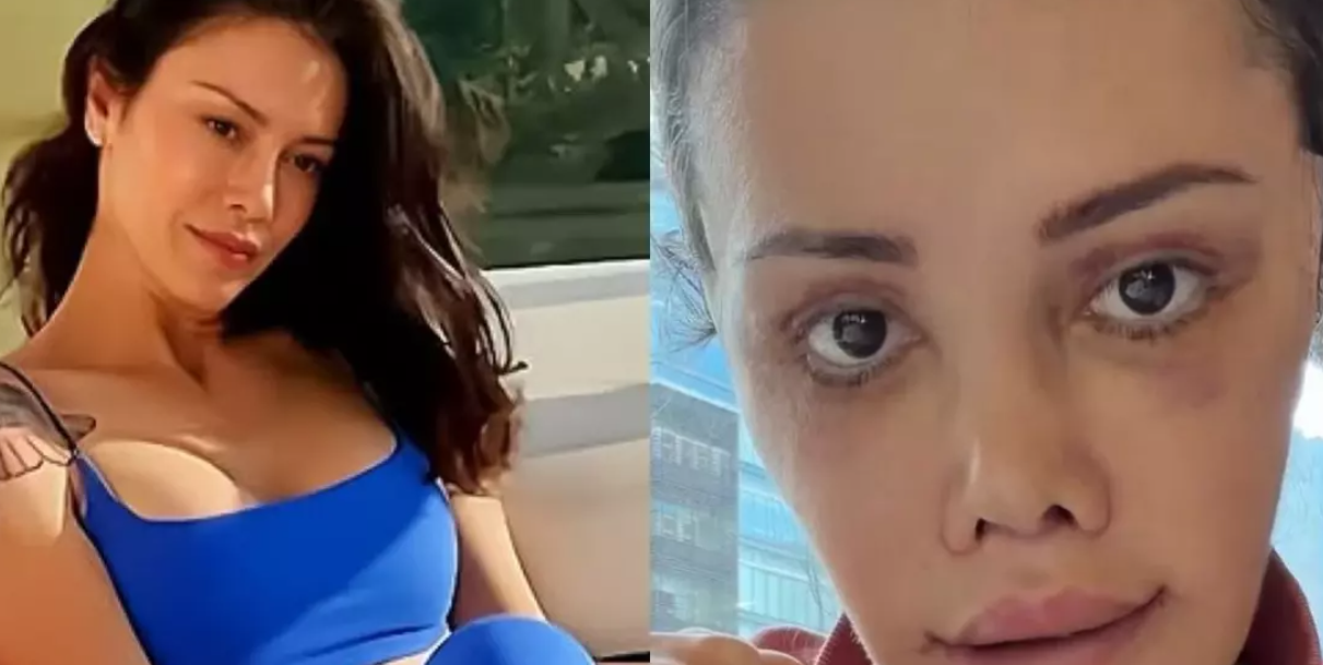 Güney Kore’de Radikal Değişim: “Harika Gözüküyorum!”