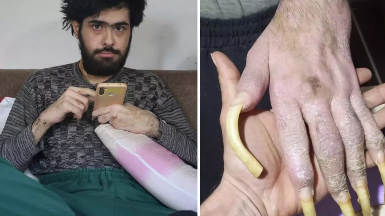 Odasından Dünyaya Açıldı: Barış Özbay Yayıncılığa Başladı!