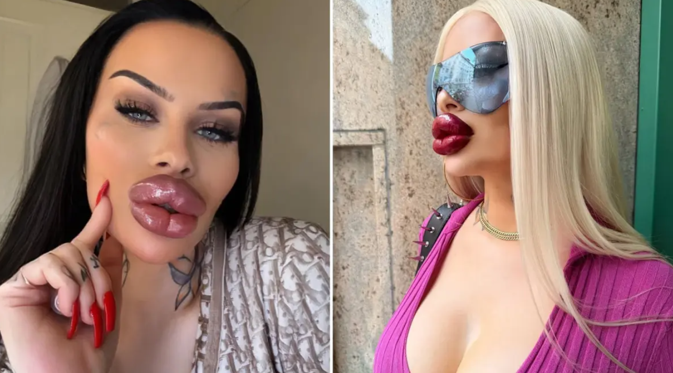 Estetiğe Harcanan 60 Bin Dolar: “Her Şey Daha Büyük Olmalı”