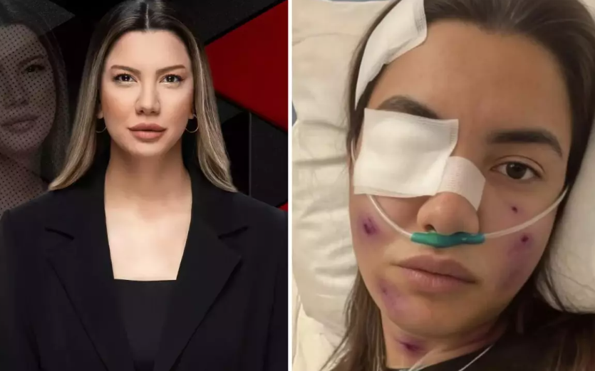 Fulya Öztürk Trafik Kazası mı Geçirdi? “Yapay Zeka” Tuzağına Sert Tepki