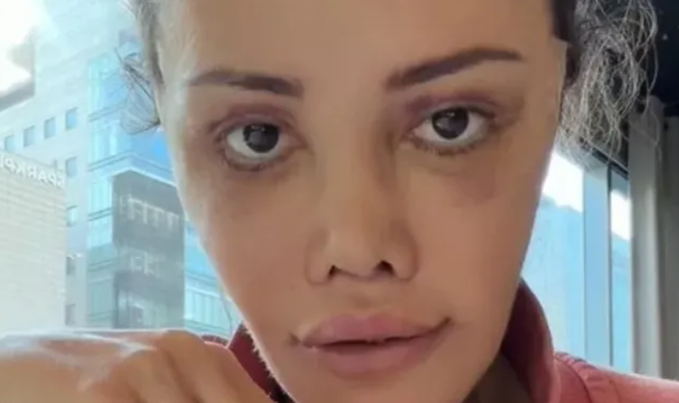 Didem Ceran’dan Yürek Burkan İtiraf: “Göğüs Kanseriyle Mücadele Ediyorum”