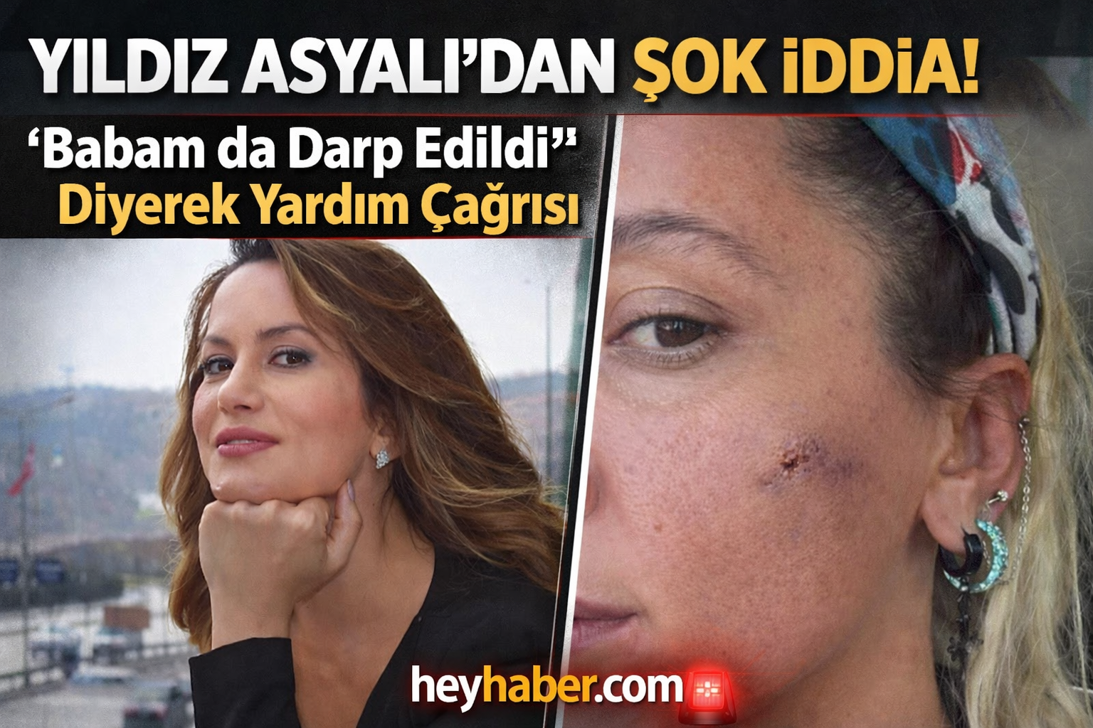 Yıldız Asyalı’dan Şok İddia! “Babam da Darp Edildi”