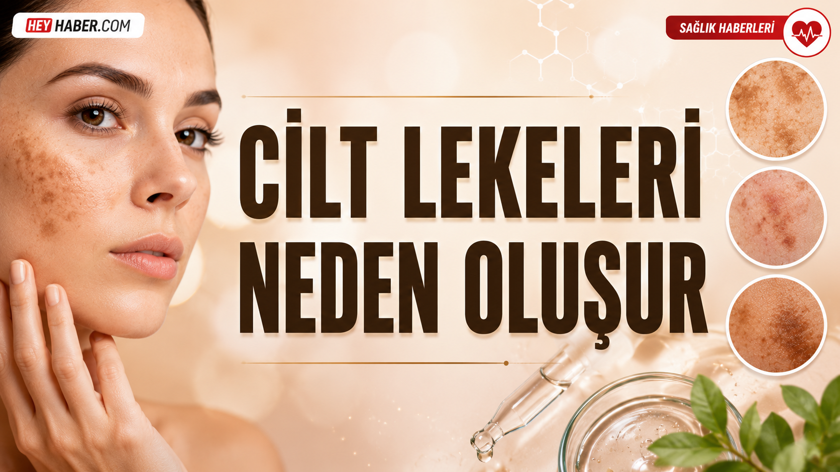 Cilt Lekeleri Neden Oluşur?